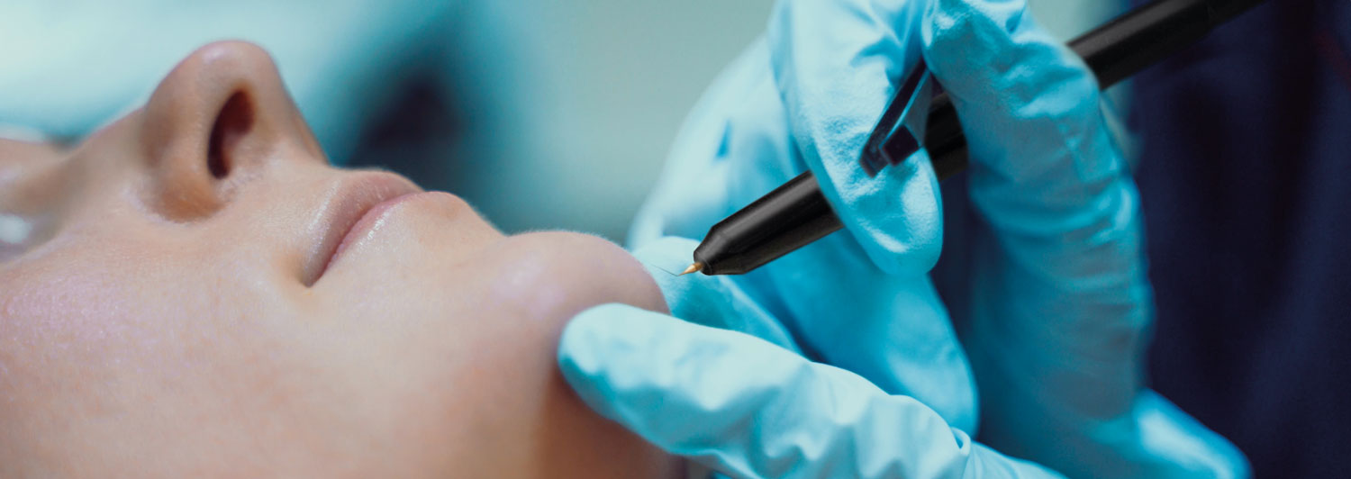 Electrolysis Hair Removal